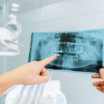 HospitalDentalVallecas_033