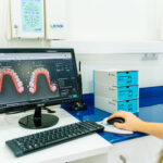 HospitalDentalVallecas_089
