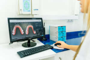 HospitalDentalVallecas_089